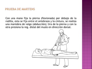 Con una mano fija la pierna (flexionada) por debajo de la
rodilla, esta se fija entre el antebrazo y la cintura, se realiza
una maniobra de valgo (abducción); tira de la pierna y con la
otra presiona la reg. distal del muslo en dirección dorsal.

 