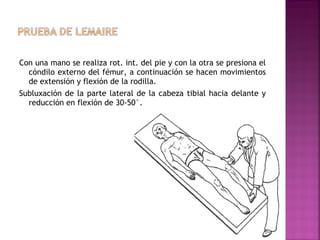 Con una mano se realiza rot. int. del pie y con la otra se presiona el
cóndilo externo del fémur, a continuación se hacen movimientos
de extensión y flexión de la rodilla.
Subluxación de la parte lateral de la cabeza tibial hacia delante y
reducción en flexión de 30-50°.

 