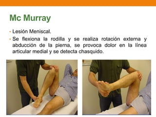 Mc Murray
• Lesión Meniscal.
• Se flexiona la rodilla y se realiza rotación externa y
abducción de la pierna, se provoca dolor en la línea
articular medial y se detecta chasquido.
 