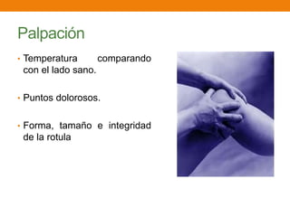 Palpación
• Temperatura comparando
con el lado sano.
• Puntos dolorosos.
• Forma, tamaño e integridad
de la rotula
 