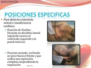 AUSCULTACIÓN




 Para detectar estenosis
  mitral e insuficiencia
  cardiaca
    Posición de Pachón:
     Paciente en decúbito lateral
     izquierdo (acerca el
     ventrículo izquierdo a la
     pared torácica)


    Paciente sentado, inclinado
     un poco hacia el frente y que
     realice una espiración
     completa suspendiendo la
     respiración      ESM-IPN        100
 