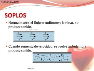 AUSCULTACIÓN




    Normalmente el flujo es uniforme y laminar, no
     produce sonido.




    Cuando aumenta de velocidad, se vuelve turbulento, y
     produce sonido.




                 ESM-IPN                                    113
 