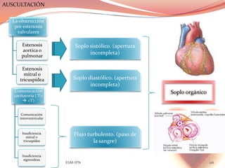 AUSCULTACIÓN

  La obstrucción
   por estenosis
    valvulares

       Estenosis             Soplo sistólico. (apertura
       aortica o
                                   incompleta)
       pulmonar

       Estenosis
        mitral o
      tricuspídea           Soplo diastólico. (apertura
                                   incompleta)
   Comunicación                                           Soplo orgánico
   cavitatoria ( T>
         <T)


       Comunicación
      interventricular



       Insuficiencia
          mitral o
                            Flujo turbulento. (paso de
        tricuspídea                 la sangre)

       Insuficiencia
        sigmoideas
                         ESM-IPN                                           116
 