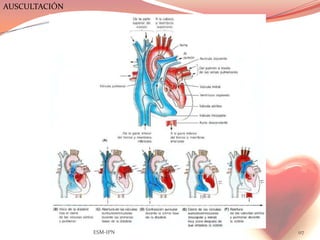 AUSCULTACIÓN




               ESM-IPN   117
 