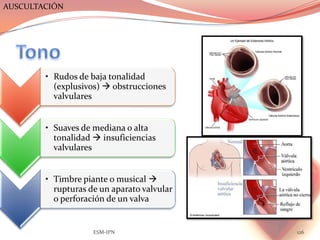 AUSCULTACIÓN




        • Rudos de baja tonalidad
          (explusivos)  obstrucciones
          valvulares


        • Suaves de mediana o alta
          tonalidad  insuficiencias
          valvulares


        • Timbre piante o musical 
          rupturas de un aparato valvular
          o perforación de un valva


                    ESM-IPN                 126
 