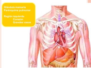 Glándula mamaria
Parénquima pulmonar

Región izquierda
       Corazón
       Grandes vasos




                        ESM-IPN
                       22
 