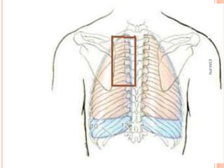 ESM-IPN
          28
 