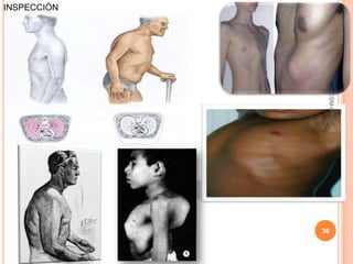 INSPECCIÓN




              ESM-IPN
             36
 