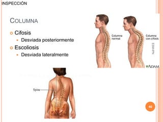 INSPECCIÓN



   COLUMNA
      Cifosis
          Desviada posteriormente




                                      ESM-IPN
      Escoliosis
          Desviada lateralmente




                                     40
 