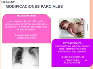 INSPECCIÓN

   MODIFICACIONES PARCIALES

             ABOMBAMIENTO

       Aumento del diámetro AP y de la
   circunferencia, el hombro esta elevado y




                                                                          ESM-IPN
  la columna y el esternón desviados hacia
              el lado lesionado.

           Lesiones pulmonares
            Lesiones pleurales

                                                     RETRACCIONES
                                              Disminución del volumen, hombro
                                                 caído, esternón y columna
                                                 desviados al lado contrario.

                                                   LESIONES LOCALES
                                                      PLEURALES         41
                                                     PULMONARES
 