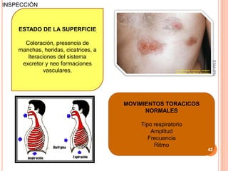 INSPECCIÓN



    ESTADO DE LA SUPERFICIE

      Coloración, presencia de
    manchas, heridas, cicatrices, a
       lteraciones del sistema




                                                               ESM-IPN
     excretor y neo formaciones
              vasculares.




                                      MOVIMIENTOS TORACICOS
                                            NORMALES

                                          Tipo respiratorio
                                              Amplitud
                                             Frecuencia
                                               Ritmo
                                                              42
 