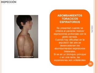 INSPECCIÓN




                ABOMBAMIENTOS
                  TORACICOS
                 ESPIRATORIOS




                                               ESM-IPN
                Se presentan cuando se
               ordena al paciente realizar
             espiraciones profundas con la
                     glotis cerrada.
              Cuando hay dificultad en la
                  expulsión del aire se
                   desencadenan los
              abombamientos espiratorios
                       bilaterales.
             Si es en un bronquio principal
                   o en una rama, las
             expansiones son unilaterales
                                              49
 
