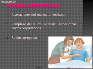 AUSCULTACIÓN




    1.   Alteraciones del murmullo vesicular

    2.   Remplazo del murmullo vesicular por otros
         ruidos respiratorios

    3.   Ruidos agregados




                        ESM-IPN                76
 