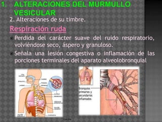2. Alteraciones de su timbre.
Respiración ruda
 Perdida del carácter suave del ruido respiratorio,
  volviéndose seco, áspero y granuloso.
 Señala una lesión congestiva o inflamación de las
  porciones terminales del aparato alveolobronquial




                    ESM-IPN            79
 