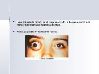  Sensibilidad a la presión en el cuero cabelludo, la bóveda craneal, o laSensibilidad a la presión en el cuero cabelludo, la bóveda craneal, o la
mandíbula observando respuesta dolorosamandíbula observando respuesta dolorosa
 Masas palpables en estructuras vecinasMasas palpables en estructuras vecinas
 