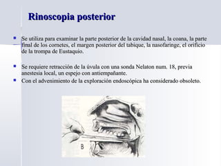 Rinoscopia posteriorRinoscopia posterior
 Se utiliza para examinar la parte posterior de la cavidad nasal, la coana, la parteSe utiliza para examinar la parte posterior de la cavidad nasal, la coana, la parte
final de los cornetes, el margen posterior del tabique, la nasofaringe, el orificiofinal de los cornetes, el margen posterior del tabique, la nasofaringe, el orificio
de la trompa de Eustaquio.de la trompa de Eustaquio.
 Se requiere retracción de la úvula con una sonda Nelaton num. 18, previaSe requiere retracción de la úvula con una sonda Nelaton num. 18, previa
anestesia local, un espejo con antiempañante.anestesia local, un espejo con antiempañante.
 Con el advenimiento de la exploración endoscópica ha considerado obsoleto.Con el advenimiento de la exploración endoscópica ha considerado obsoleto.
 