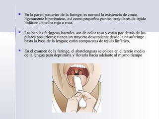  En la pared posterior de la faringe, es normal la existencia de zonasEn la pared posterior de la faringe, es normal la existencia de zonas
ligeramente hiperémicas, así como pequeños puntos irregulares de tejidoligeramente hiperémicas, así como pequeños puntos irregulares de tejido
linfático de color rojo o rosa.linfático de color rojo o rosa.
 Las bandas faríngeas laterales son de color rosa y están por detrás de losLas bandas faríngeas laterales son de color rosa y están por detrás de los
pilares posteriores; tienen un trayecto descendente desde la nasofaringepilares posteriores; tienen un trayecto descendente desde la nasofaringe
hasta la base de la lengua; están compuestas de tejido linfático.hasta la base de la lengua; están compuestas de tejido linfático.
 En el examen de la faringe, el abatelenguas se coloca en el tercio medioEn el examen de la faringe, el abatelenguas se coloca en el tercio medio
de la lengua para deprimirla y llevarla hacia adelante al mismo tiempode la lengua para deprimirla y llevarla hacia adelante al mismo tiempo
 