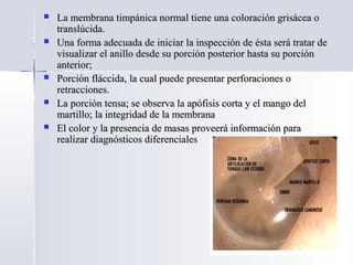  La membrana timpánica normal tiene una coloración grisácea oLa membrana timpánica normal tiene una coloración grisácea o
translúcida.translúcida.
 Una forma adecuada de iniciar la inspección de ésta será tratar deUna forma adecuada de iniciar la inspección de ésta será tratar de
visualizar el anillo desde su porción posterior hasta su porciónvisualizar el anillo desde su porción posterior hasta su porción
anterior;anterior;
 Porción fláccida, la cual puede presentar perforaciones oPorción fláccida, la cual puede presentar perforaciones o
retracciones.retracciones.
 La porción tensa; se observa la apófisis corta y el mango delLa porción tensa; se observa la apófisis corta y el mango del
martillo; la integridad de la membranamartillo; la integridad de la membrana
 El color y la presencia de masas proveerá información paraEl color y la presencia de masas proveerá información para
realizar diagnósticos diferencialesrealizar diagnósticos diferenciales
 