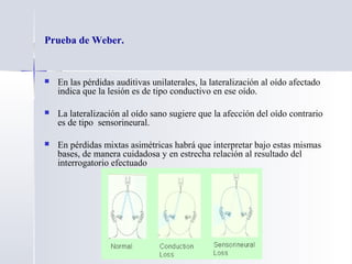 Prueba de Weber.
 En las pérdidas auditivas unilaterales, la lateralización al oído afectado
indica que la lesión es de tipo conductivo en ese oído.
 La lateralización al oído sano sugiere que la afección del oído contrario
es de tipo sensorineural.
 En pérdidas mixtas asimétricas habrá que interpretar bajo estas mismas
bases, de manera cuidadosa y en estrecha relación al resultado del
interrogatorio efectuado
 