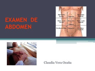 EXAMEN DE
ABDOMEN
Claudia Vera Ocaña
 