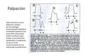 Palpación
Cabe mencionar que la
dilatación cardiaca
de otra etiología
(miocardiopatía dilatada o
cardiopatía isquémica con
grave daño miocardios),
puede manifestar ápex
amplio y anormalmente
desplazado a la palpación,
sin que se trate
necesariamente de una
sobrecarga hemodinámica.
 