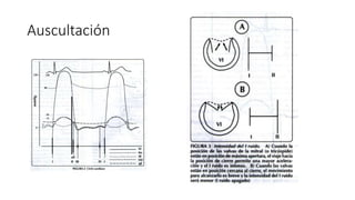 Auscultación
 