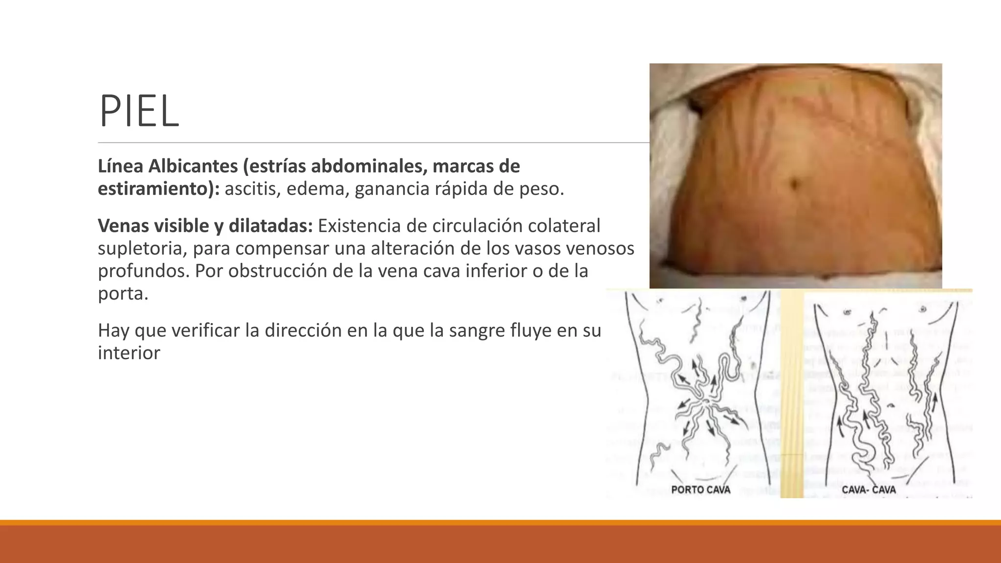 EXPLORACIÓN FÍSICA DE ABDOMEN.pptx