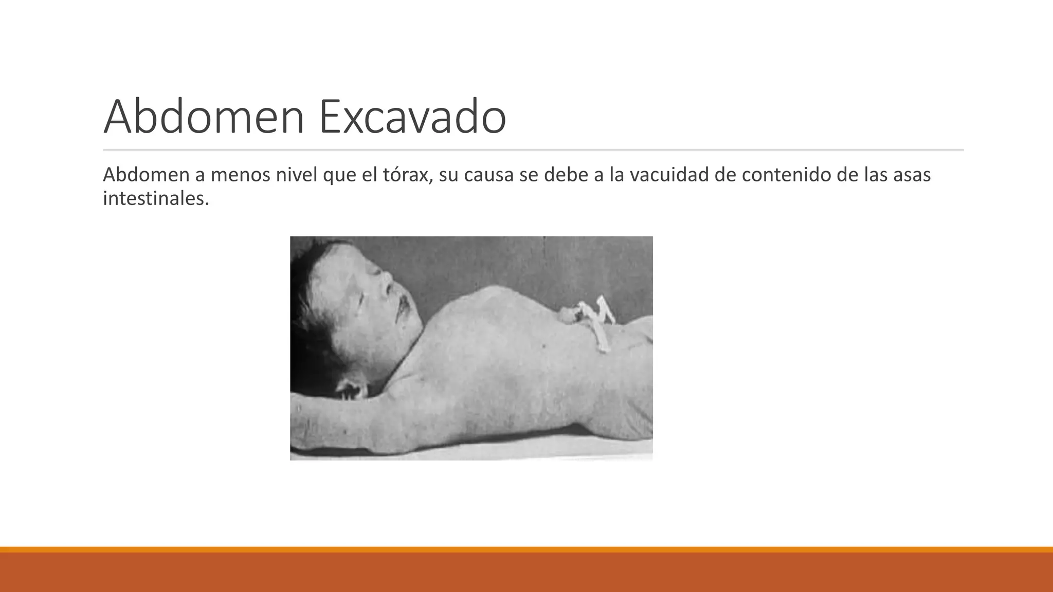 EXPLORACIÓN FÍSICA DE ABDOMEN.pptx