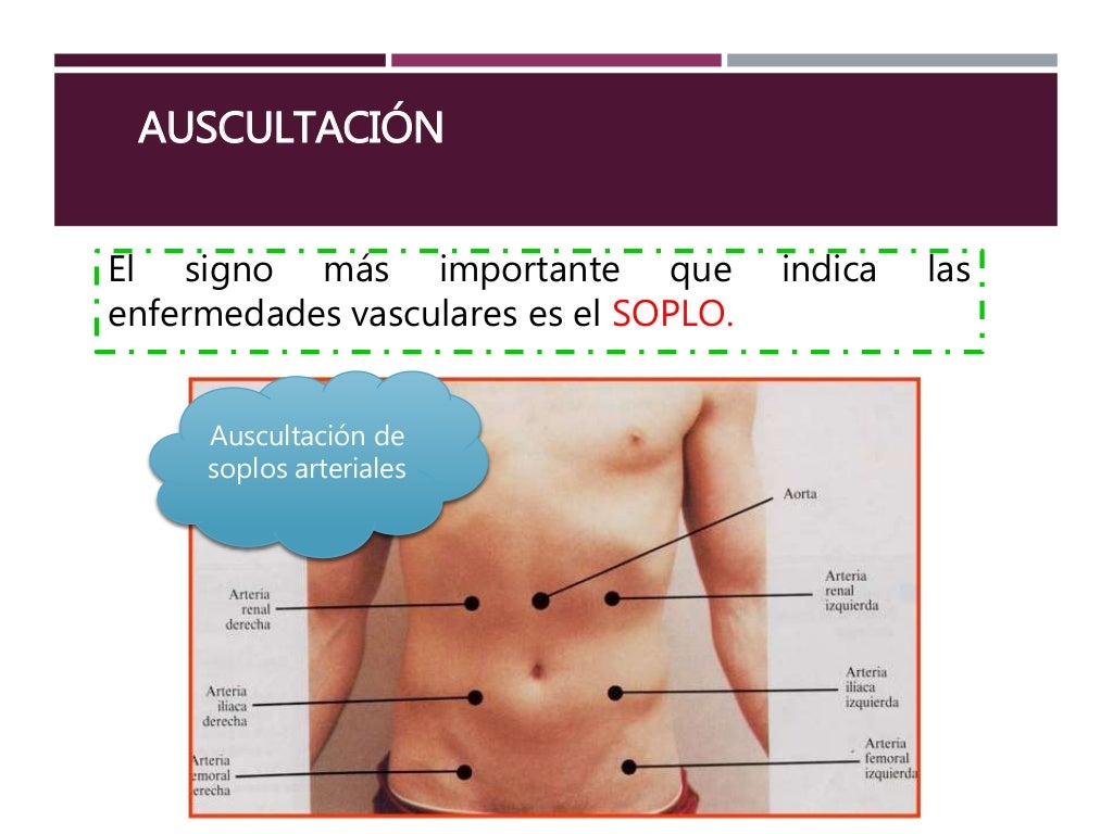 Exploración física del abdomen