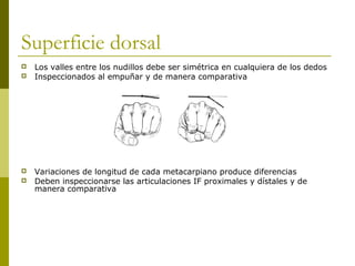 Superficie dorsal
 Los valles entre los nudillos debe ser simétrica en cualquiera de los dedos
 Inspeccionados al empuñar y de manera comparativa
 Variaciones de longitud de cada metacarpiano produce diferencias
 Deben inspeccionarse las articulaciones IF proximales y dístales y de
manera comparativa
 