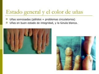 Estado general y el color de uñas
 Uñas sonrosadas (pálidos = problemas circulatorios)
 Uñas en buen estado de integridad, y la lúnula blanca.
 