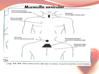 Murmullo vesicular
 Suave, largo y continuo
 Se percibe en todas las partes en que el pulmón esta
en contacto con la pared torácica.
 Cara anterior en los dos primeros espacios
intercostales, en las regiones axilares e
infraescapulares.
 Ruido inspiratorio continuo
 Ruido alveolar
 