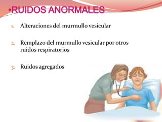 1. Alteraciones del murmullo vesicular
2. Remplazo del murmullo vesicular por otros
ruidos respiratorios
3. Ruidos agregados
 