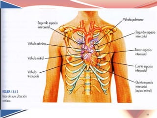 59
Focos:
1. Aórtico
Sobre el 2º espacio
intercostal, línea
paraesternal
derecha.
Focos:
2º Pulmonar
2º espacio
intercostal, línea
paraesternal
izquierda
Focos:
3. Aórtico Accesorio
Sobre el 3º espacio
intercostal, línea
paraesternal
izquierda.
Focos:
4. Tricuspideo
Sobre el 5º espacio
intercostal, línea
paraesternal
izquierdo.
Focos:
5. Mitral o
apexiano
Sobre el 5º espacio
intercostal, línea
media clavicular.
 