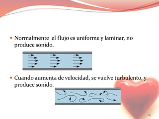  Normalmente el flujo es uniforme y laminar, no
produce sonido.
 Cuando aumenta de velocidad, se vuelve turbulento, y
produce sonido.
67
 