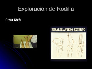 Exploración de Rodilla
Pivot Shift

 