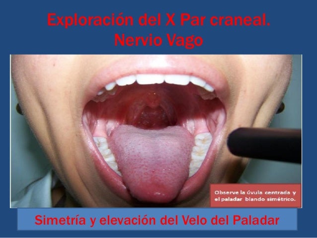 Resultado de imagen para exploracion fisica del nervio vago