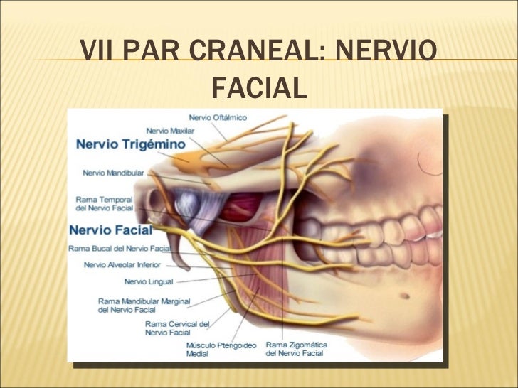 VII NERVIO FACIAL