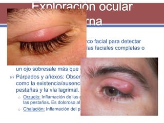    Es necesario observar el marco facial para detectar
    asimetrías orbitarias, asimetrías faciales completas o
    hemifaciales, desviaciones.
   Hay que valorar de perfil o desde arriba para detectar si
    un ojo sobresale más que el otro.
   Párpados y añexos: Observar los bordes y la piel, así
    como la existencia/ausencia de bultomas, las cejas, las
    pestañas y la vía lagrimal.
    o Orzuelo: Inflamación de las glándulas sebáceas en la base de
      las pestañas. Es doloroso al contacto.
    o Chalación: Inflamación del párpado. Indoloro.
 
