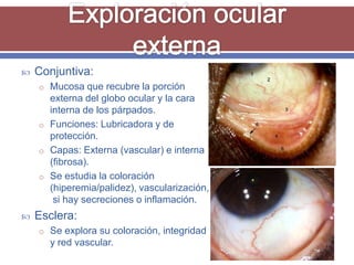    Conjuntiva:
    o Mucosa que recubre la porción
      externa del globo ocular y la cara
      interna de los párpados.
    o Funciones: Lubricadora y de
      protección.
    o Capas: Externa (vascular) e interna
      (fibrosa).
    o Se estudia la coloración
      (hiperemia/palidez), vascularización,
       si hay secreciones o inflamación.
   Esclera:
    o Se explora su coloración, integridad
      y red vascular.
 