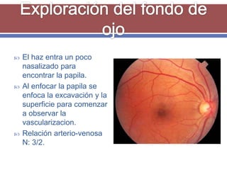    El haz entra un poco
    nasalizado para
    encontrar la papila.
   Al enfocar la papila se
    enfoca la excavación y la
    superficie para comenzar
    a observar la
    vascularizacion.
   Relación arterio-venosa
    N: 3/2.
 