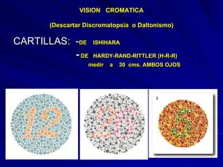 Hardy Randy Rittler Exploración oftalmologica. | PPT
