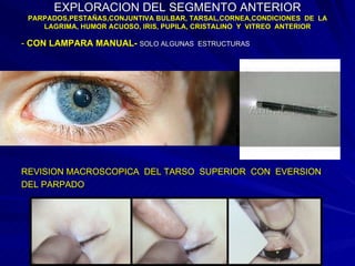 EXPLORACION DEL SEGMENTO ANTERIOR PARPADOS,PESTAÑAS,CONJUNTIVA BULBAR, TARSAL,CORNEA,CONDICIONES  DE  LA LAGRIMA, HUMOR ACUOSO, IRIS, PUPILA, CRISTALINO  Y  VITREO  ANTERIOR -  CON LAMPARA MANUAL-   SOLO ALGUNAS  ESTRUCTURAS REVISION MACROSCOPICA  DEL TARSO  SUPERIOR  CON  EVERSION DEL PARPADO 