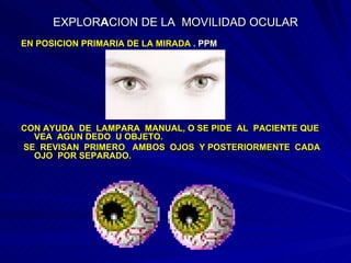 EXPLOR A CION DE LA  MOVILIDAD OCULAR EN POSICION PRIMARIA DE LA MIRADA .  PPM CON AYUDA  DE  LAMPARA  MANUAL, O SE PIDE  AL  PACIENTE QUE  VEA  AGUN DEDO  U OBJETO. SE  REVISAN  PRIMERO  AMBOS  OJOS  Y POSTERIORMENTE  CADA  OJO  POR SEPARADO. 