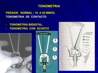 TONOMETRIA PRESION  NORMAL : 10  A 20 MMHG. TONOMETRIA  DE  CONTACTO TONOMETRIA BIDIGITAL. TONOMETRIA  CON  SCHIOTZ 