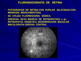 FLURANGIOGRAFIA  DE  RETINA  FOTOGRAFIAS  DE  RETINA CON  PUPILAS  DILATADAS CON MIDRIASIS  MEDICAMENTOSA. SE  UTILIZA  FLUORESCEINA  SODICA. ESENCIAL  EN EL MANEJO  DE  RETINOPATIAS: v. gr.  RETINOPATIA  DIABETICA, DEGENERACION  MACULAR, MACULOPATIA SEROSA  CENTRAL. 