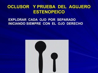 OCLUSOR  Y PRUEBA  DEL  AGUJERO ESTENOPEICO EXPLORAR  CADA  OJO  POR  SEPARADO INICIANDO SIEMPRE  CON  EL  OJO  DERECHO 