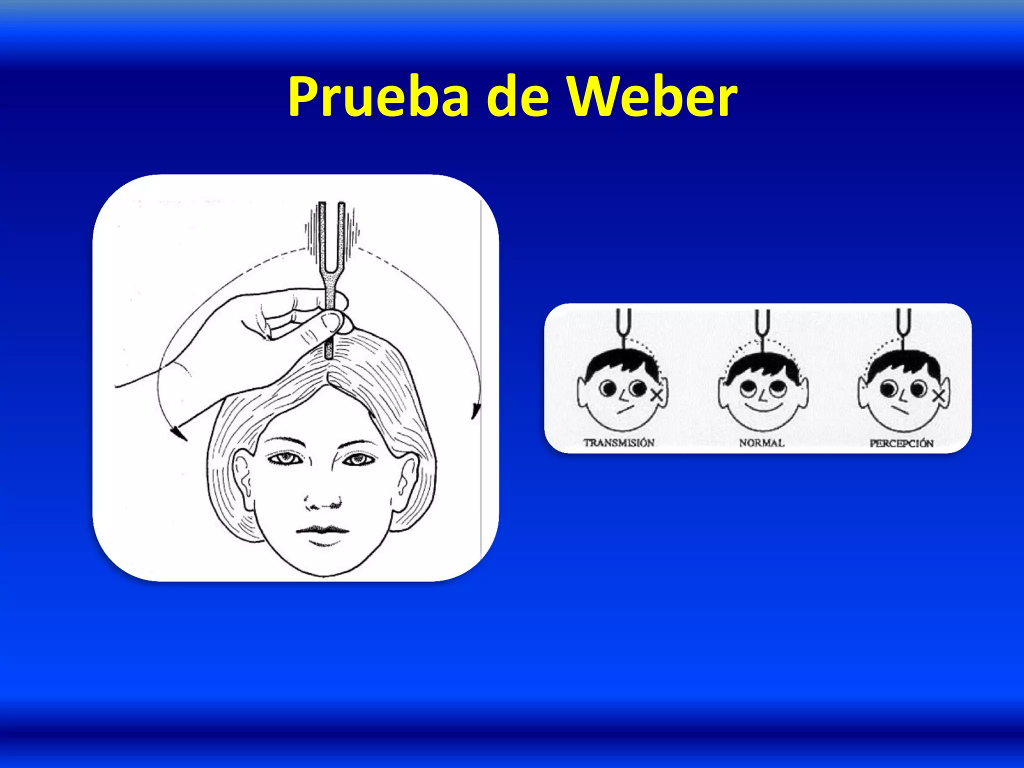 Prueba de Weber