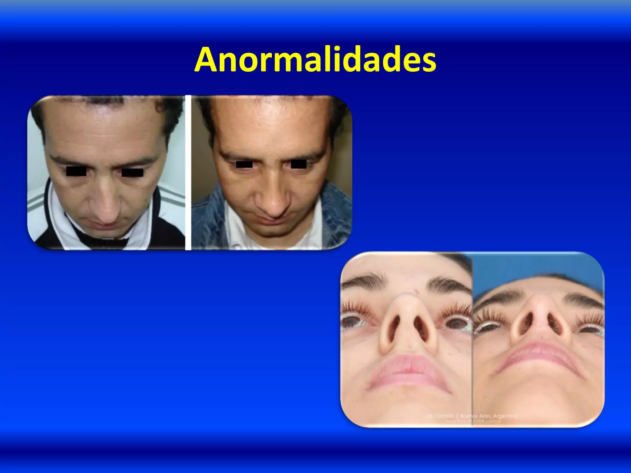 Anormalidades