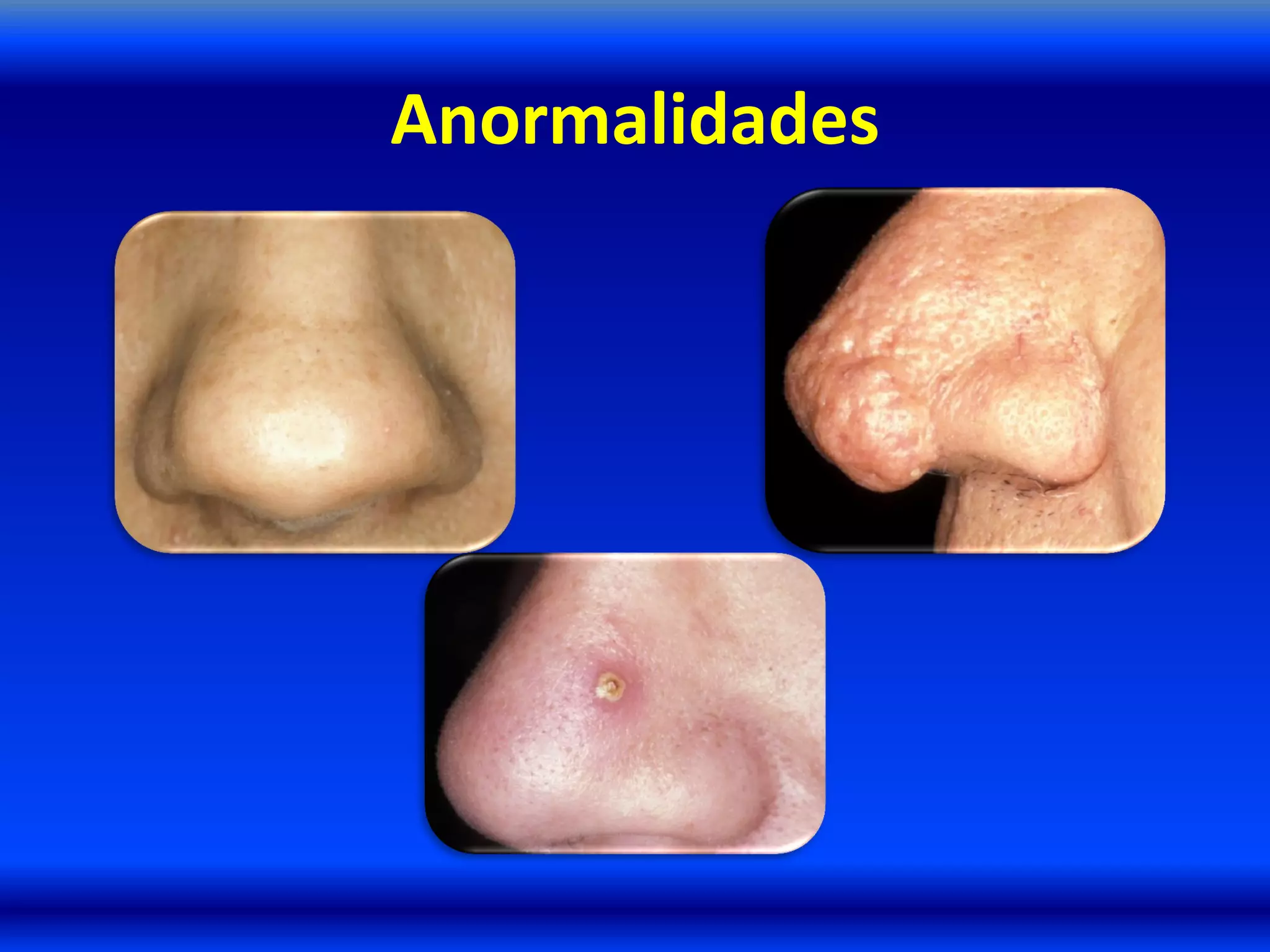 Anormalidades